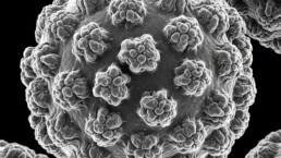 Ki-generiertes EMBild Masernvirus